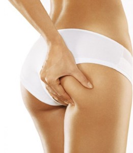 rimedi naturali per la cellulite